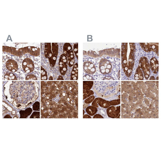 PBLD Antibody in Immunohistochemistry (IHC)