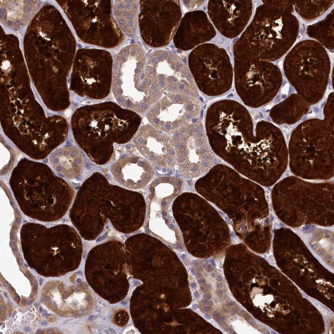 PBLD Antibody in Immunohistochemistry (IHC)