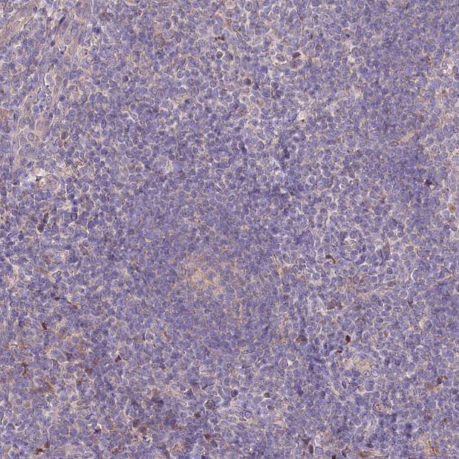 PBLD Antibody in Immunohistochemistry (IHC)