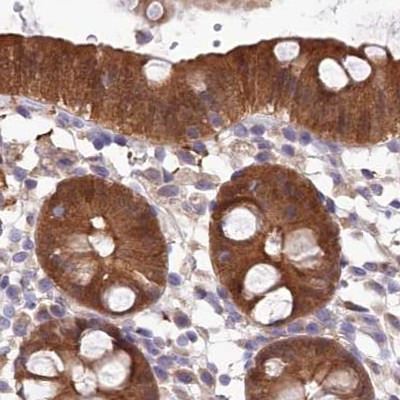 PBLD Antibody in Immunohistochemistry (IHC)