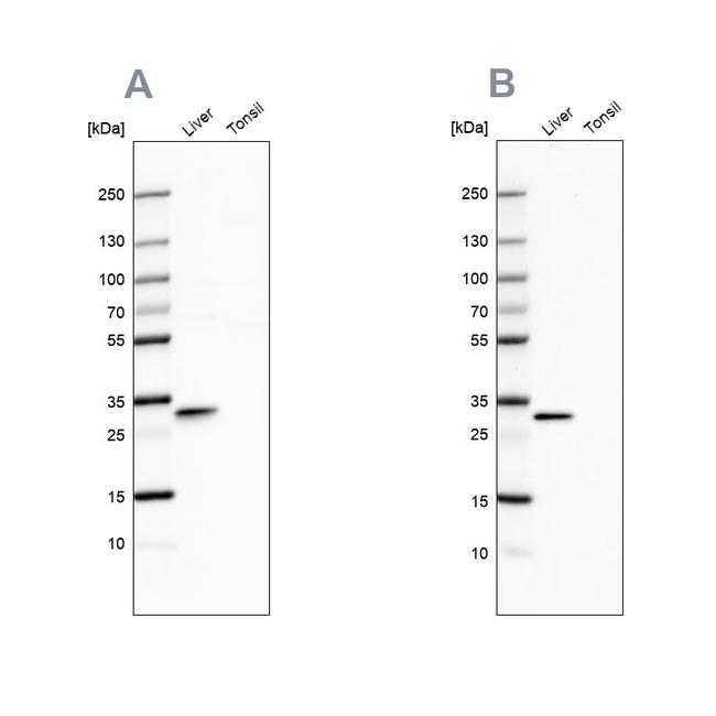 PBLD Antibody in Western Blot (WB)