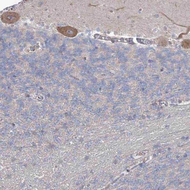 3BP5L Antibody in Immunohistochemistry (IHC)