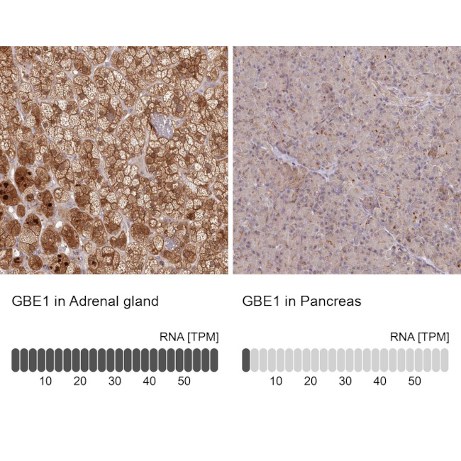 GBE1 Antibody in Immunohistochemistry (IHC)