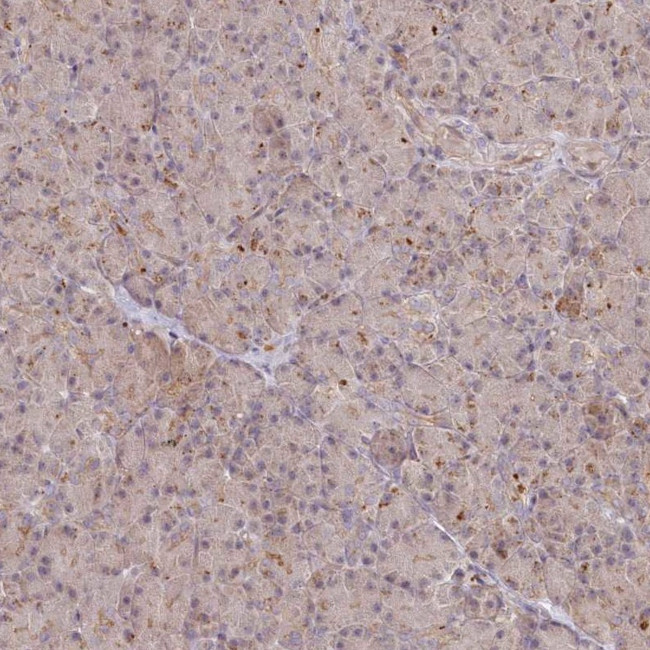 GBE1 Antibody in Immunohistochemistry (IHC)