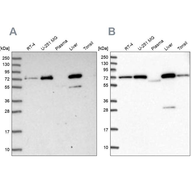 GBE1 Antibody in Western Blot (WB)