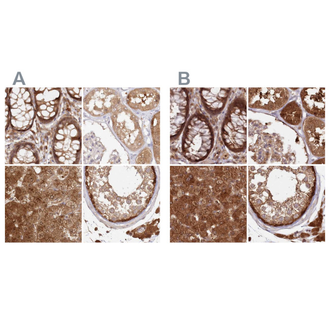 GBE1 Antibody in Immunohistochemistry (IHC)