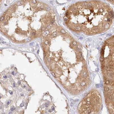 GBE1 Antibody in Immunohistochemistry (IHC)