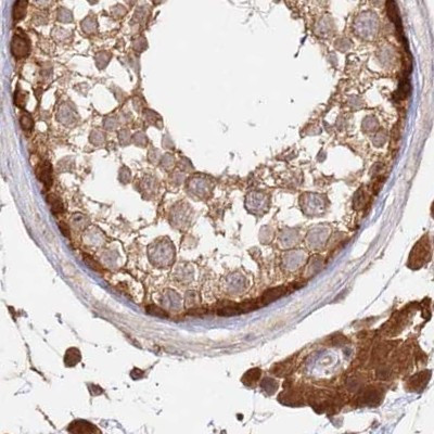 GBE1 Antibody in Immunohistochemistry (IHC)