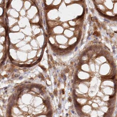 GBE1 Antibody in Immunohistochemistry (IHC)