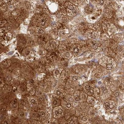 GBE1 Antibody in Immunohistochemistry (IHC)