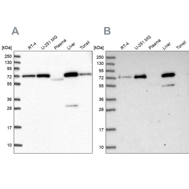 GBE1 Antibody in Western Blot (WB)