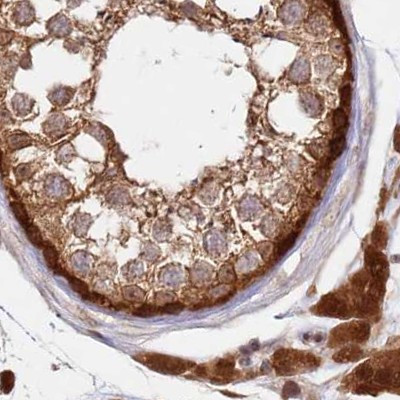 GBE1 Antibody in Immunohistochemistry (IHC)