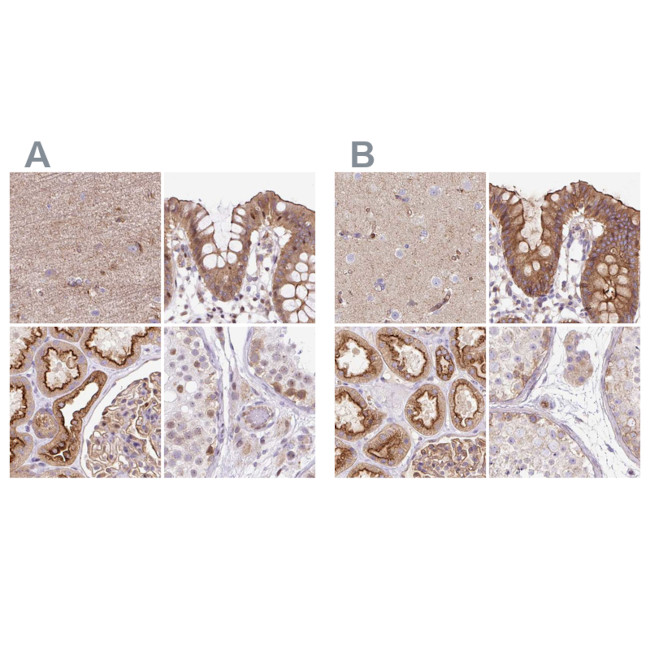 HIP1R Antibody in Immunohistochemistry (IHC)