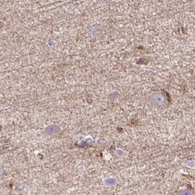 HIP1R Antibody in Immunohistochemistry (IHC)