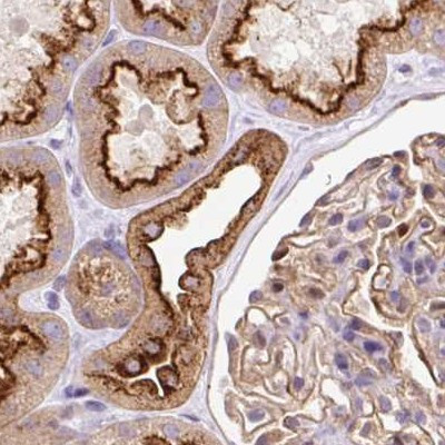 HIP1R Antibody in Immunohistochemistry (IHC)