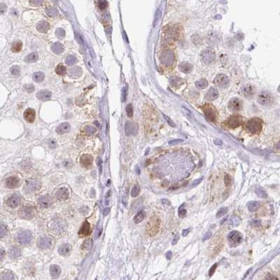 HIP1R Antibody in Immunohistochemistry (IHC)