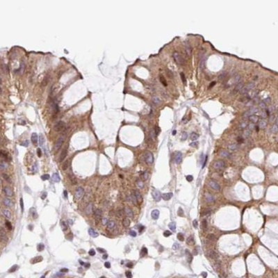 HIP1R Antibody in Immunohistochemistry (IHC)