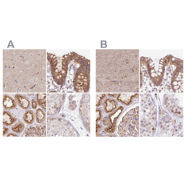 HIP1R Antibody in Immunohistochemistry (IHC)