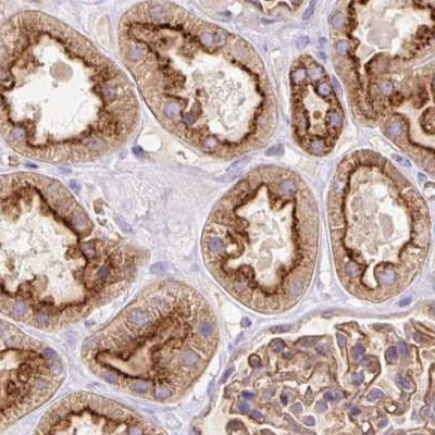 HIP1R Antibody in Immunohistochemistry (IHC)