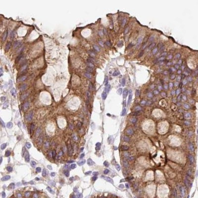 HIP1R Antibody in Immunohistochemistry (IHC)