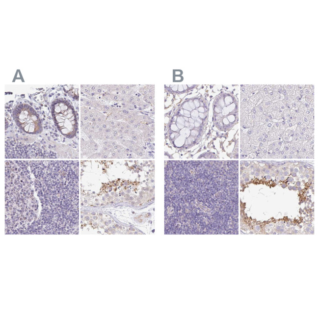 PLCD4 Antibody in Immunohistochemistry (IHC)