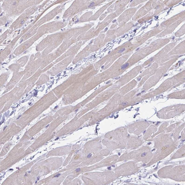 PLCD4 Antibody in Immunohistochemistry (IHC)