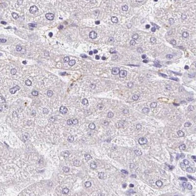 PLCD4 Antibody in Immunohistochemistry (IHC)