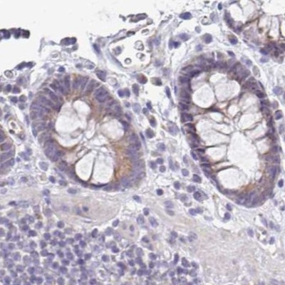 PLCD4 Antibody in Immunohistochemistry (IHC)