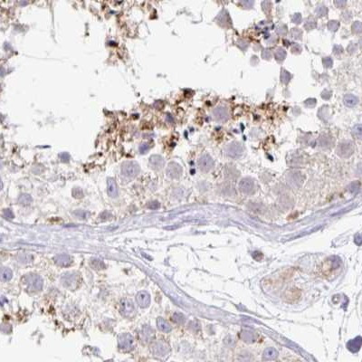 PLCD4 Antibody in Immunohistochemistry (IHC)