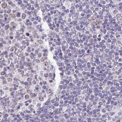 PLCD4 Antibody in Immunohistochemistry (IHC)