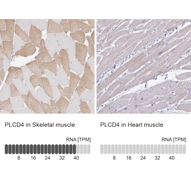 PLCD4 Antibody