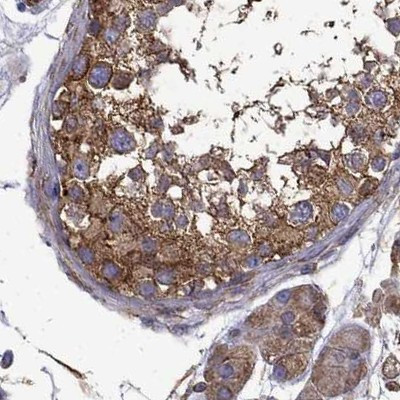 MAP4 Antibody in Immunohistochemistry (IHC)