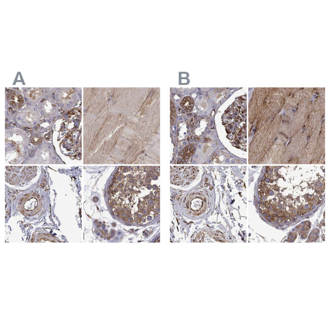 MAP4 Antibody in Immunohistochemistry (IHC)