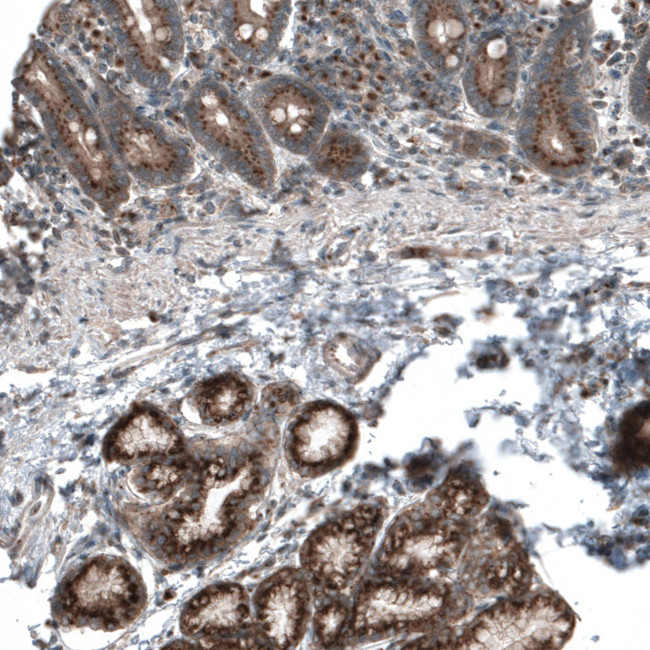 TBC1D23 Antibody in Immunohistochemistry (IHC)