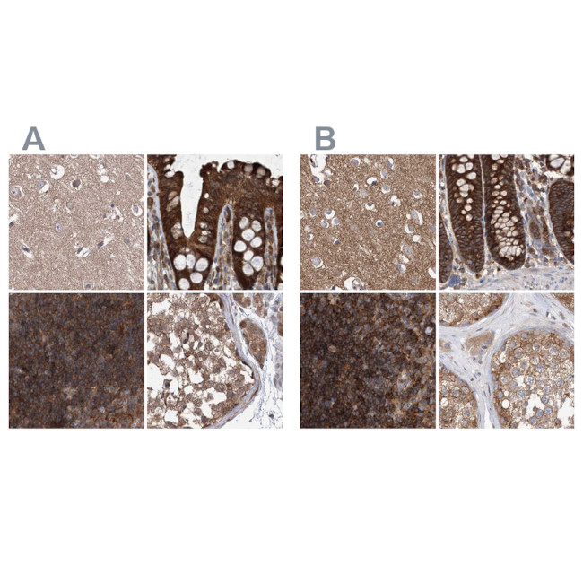 VPS37B Antibody in Immunohistochemistry (IHC)