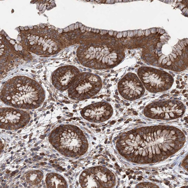 VPS37B Antibody in Immunohistochemistry (IHC)