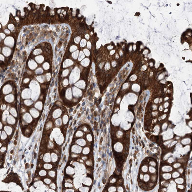 VPS37B Antibody in Immunohistochemistry (IHC)