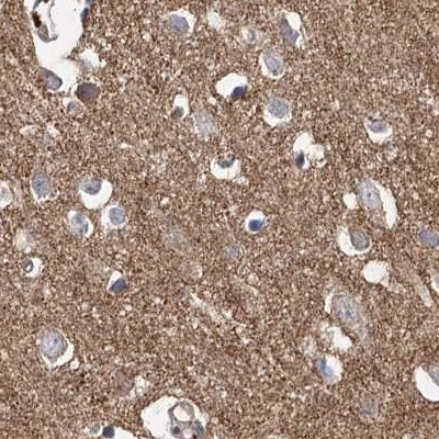 VPS37B Antibody in Immunohistochemistry (IHC)