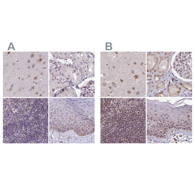 TCOF1 Antibody in Immunohistochemistry (IHC)