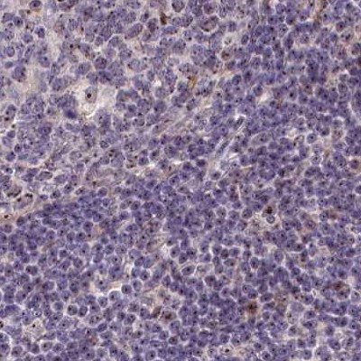 TCOF1 Antibody in Immunohistochemistry (IHC)