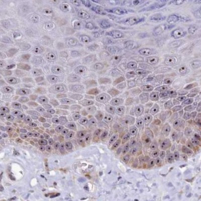 TCOF1 Antibody in Immunohistochemistry (IHC)