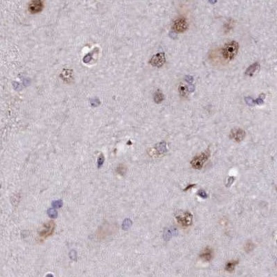 TCOF1 Antibody in Immunohistochemistry (IHC)