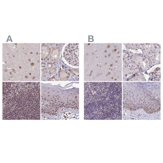 TCOF1 Antibody in Immunohistochemistry (IHC)