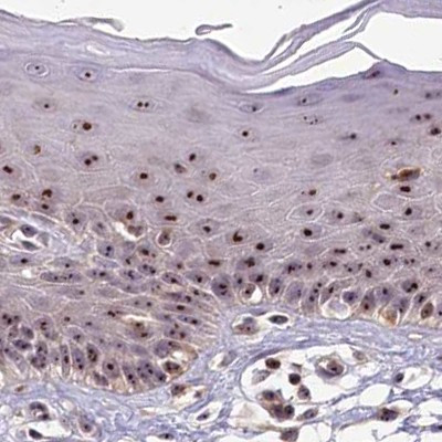 TCOF1 Antibody in Immunohistochemistry (IHC)