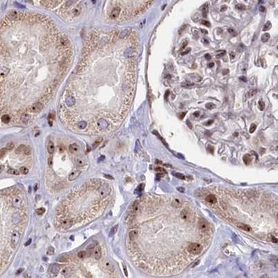 TCOF1 Antibody in Immunohistochemistry (IHC)