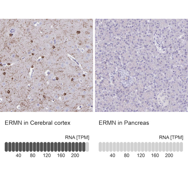 ERMN Antibody in Immunohistochemistry (IHC)