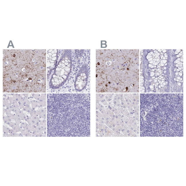 ERMN Antibody in Immunohistochemistry (IHC)