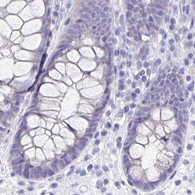 ERMN Antibody in Immunohistochemistry (IHC)