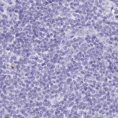 ERMN Antibody in Immunohistochemistry (IHC)