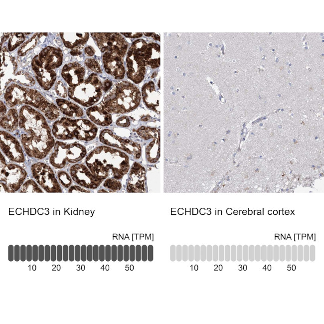 ECHDC3 Antibody in Immunohistochemistry (IHC)